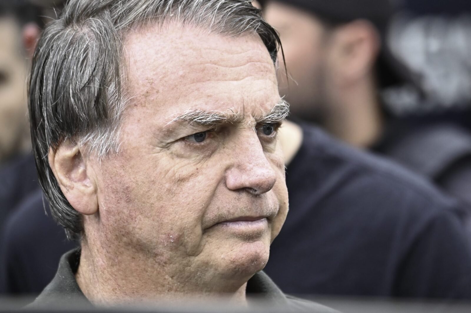 Bolsonaro undergoes medical procedure to