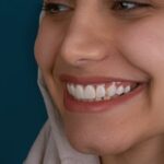 الولادة القيصرية