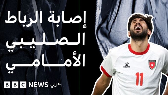 صورة للاعب كرة القدم يتعرض لإصابة الرباط الصليبي