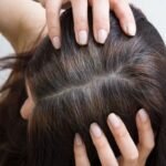 صورة لشخص يظهر عليه الشيب المبكر.