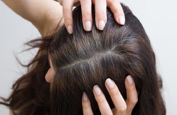 صورة لشخص يظهر عليه الشيب المبكر.