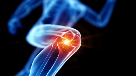 صورة لجسم بشري مع عظام سليمة