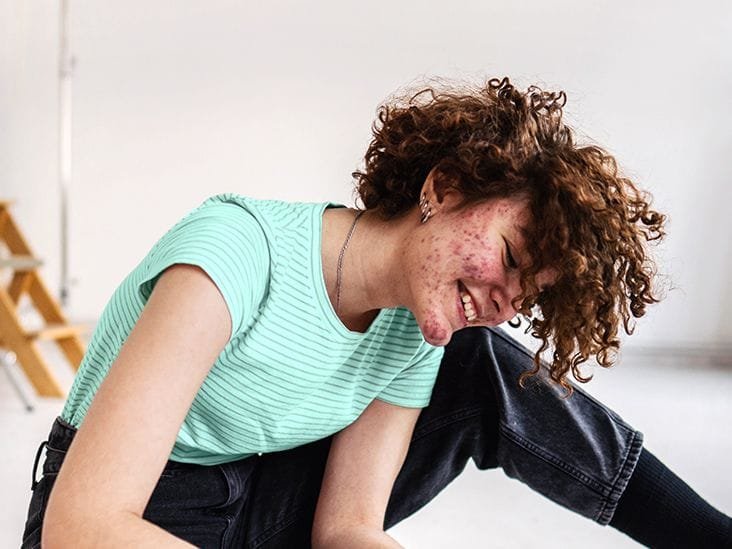 Hidradenitis Suppurativa symptoms