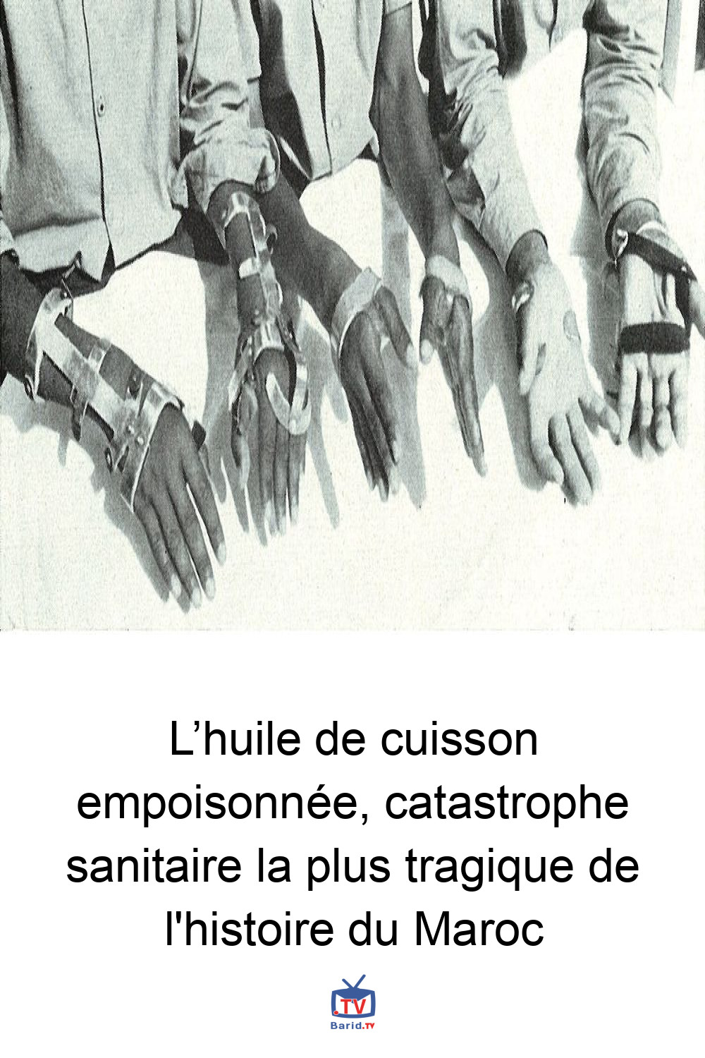 L’huile de cuisson empoisonnée, catastrophe sanitaire la plus tragique de l'histoire du Maroc 4 Pinterest Hidden