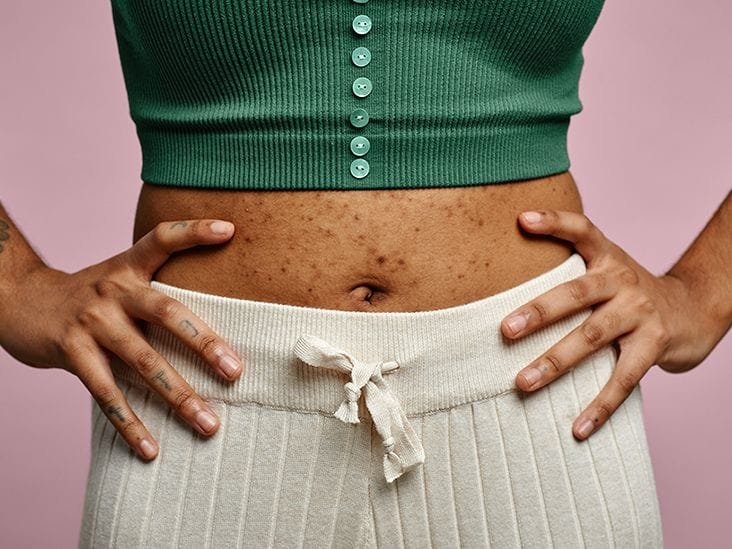 A person examining their skin in a mirror