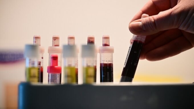 فحوصات سنوية، كشف مبكر للأمراض، صحة وقائية