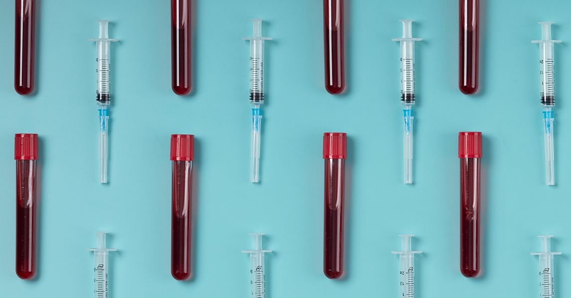 A person's hand wearing an Oura Ring, with a blurred background of a laboratory or health setting.