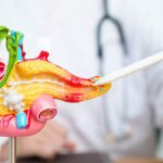 Cancer du Pancréas : Une Trithérapie Révolutionnaire Espagnole Redonne Espoir 8 Illustration scientifique d'une cellule pancréatique avec des molécules de trithérapie ciblant l'oncogène KRAS, symbolisant l'espoir dans la recherche contre le cancer du pancréas.