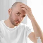 صورة توضيحية لكريم كلاسكوتيرون الموضعي لعلاج تساقط الشعر والصلع الوراثي