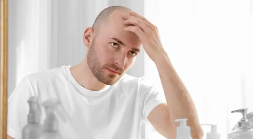 صورة توضيحية لكريم كلاسكوتيرون الموضعي لعلاج تساقط الشعر والصلع الوراثي