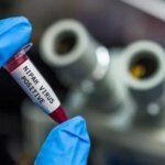 صورة مجهرية لفيروس نيباه أو باحثين في مختبر يعملون على تطوير لقاح