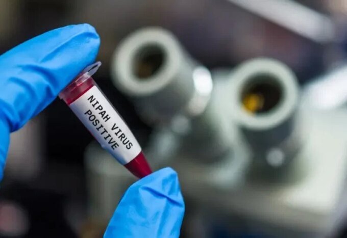 صورة مجهرية لفيروس نيباه أو باحثين في مختبر يعملون على تطوير لقاح