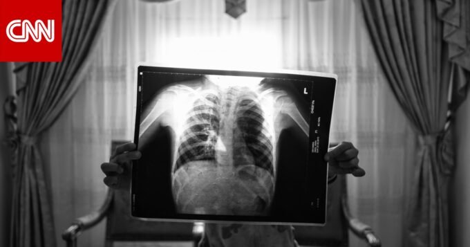 صور من مشروع "غبار القمر" للمصور محمد مهدي توثق معاناة سكان وادي القمر بالإسكندرية.