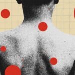 Illustration depicting a child with chickenpox blisters, symbolizing the historical prevalence of the virus before widespread vaccination.