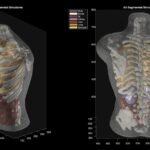 A segmented imaging phantom scan, demonstrating clean structural separation under controlled conditions, representing Midjourney Medical's technology.