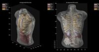 A segmented imaging phantom scan, demonstrating clean structural separation under controlled conditions, representing Midjourney Medical's technology.