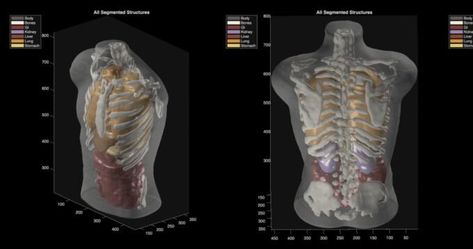 A segmented imaging phantom scan, demonstrating clean structural separation under controlled conditions, representing Midjourney Medical's technology.