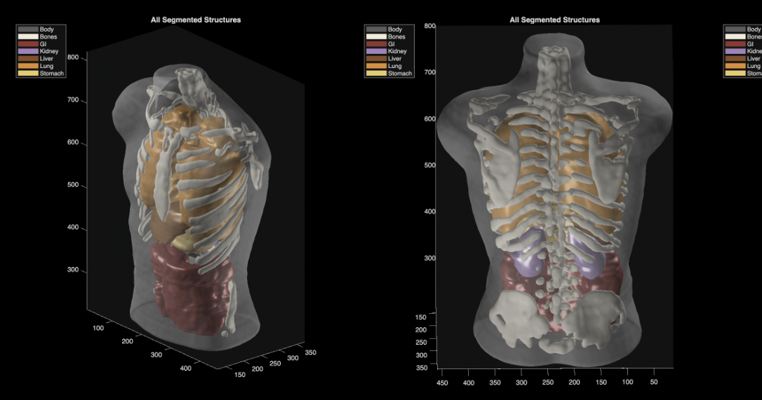 A segmented imaging phantom scan, demonstrating clean structural separation under controlled conditions, representing Midjourney Medical's technology.