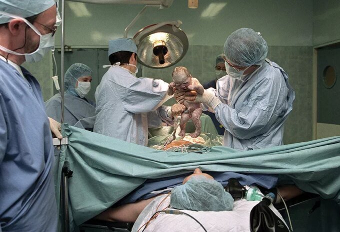 Une femme enceinte en consultation avec son gynécologue, discutant des options d'accouchement, avec un focus sur la décision de césarienne.